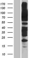 FACT / SSRP1 Protein (Over-Expression Lysate Myc-DDK (Flag))
