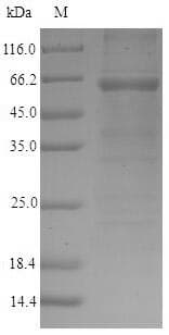 Mouse GOLM1 / GP73 / GOLPH2 Protein (Recombinant 6His-SUMO, N-terminus)