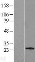 Human C1orf158 Protein (Over-Expression Lysate Myc-DDK (Flag))