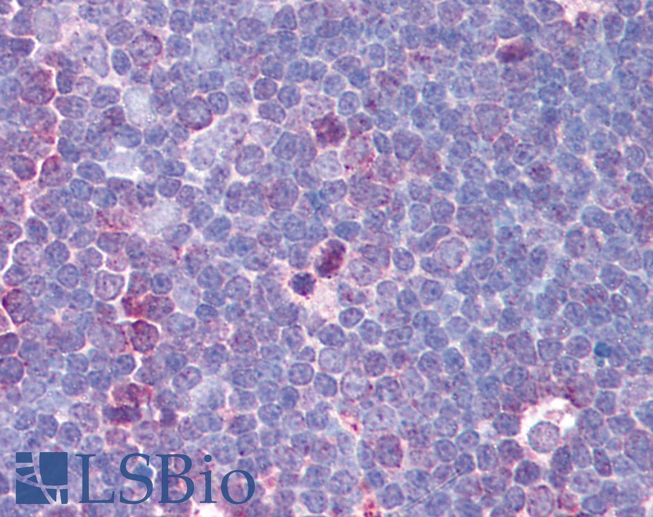 IHC-plus™ KIF11 / EG5 Antibody