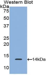 CCL5 / RANTES Antibody (aa24-91)