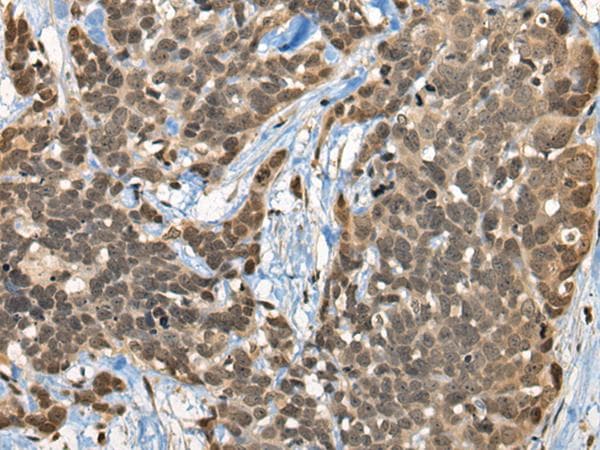 CBFA2T3 Antibody