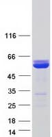 Human XRCC4 Protein (Recombinant Myc-DDK (Flag))