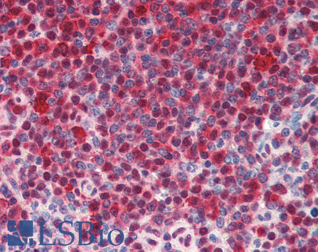 IHC-plus™ HSPA8 / HSC70 Antibody (clone 1B5)