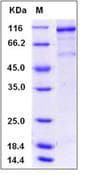 Human KDR / VEGFR2 / FLK1 Protein (Recombinant His-GST, N-terminus)