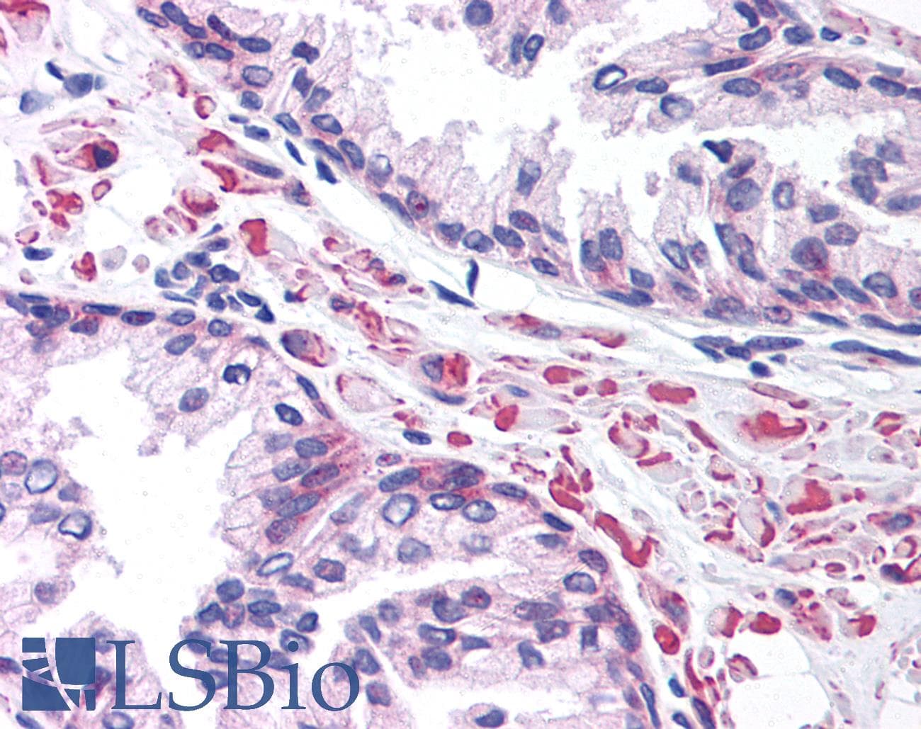 LEF1 Antibody (aa51-100)