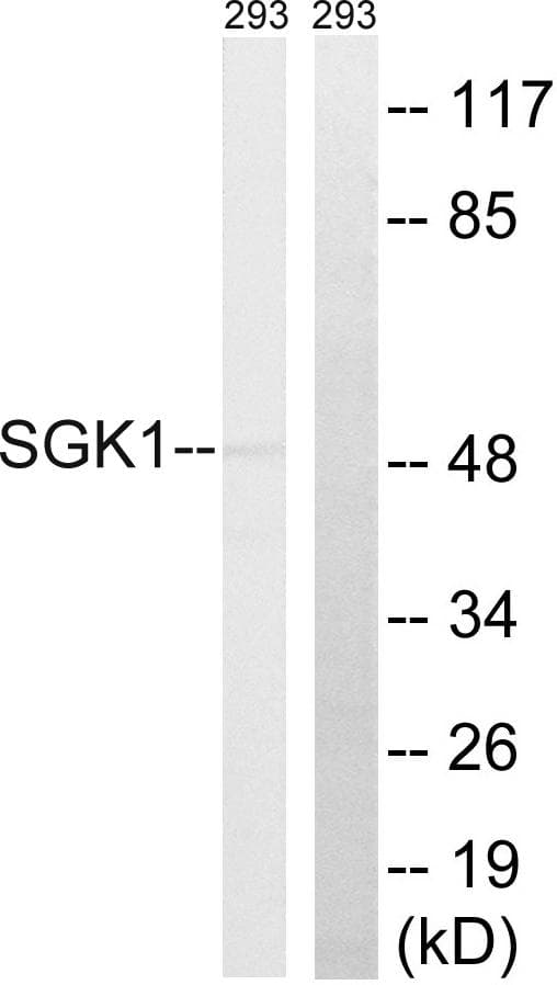 SGK1 / SGK Antibody (p256)