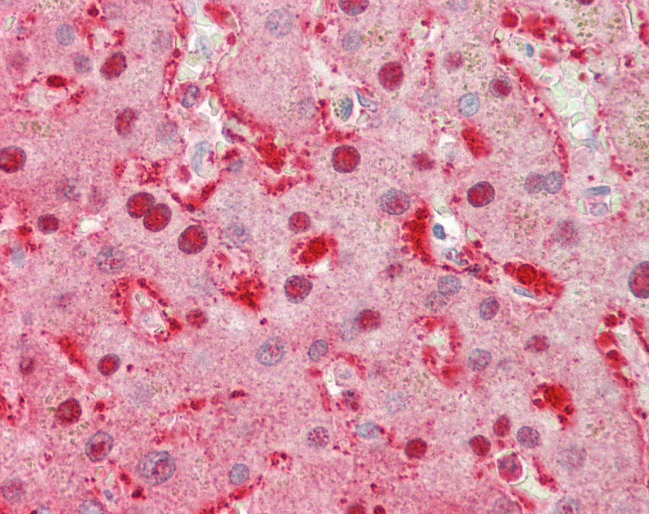SPG21 / MAST Antibody (aa217-266)