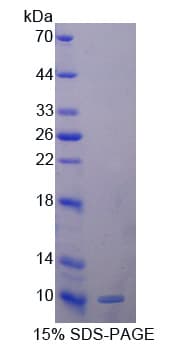 Human GPX3 Protein (Recombinant His-T7)