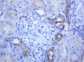 Monoclonal Mouse anti-Human ABCB1 / MDR1 / P Glycoprotein Antibody (clone OTI5B3, IHC)