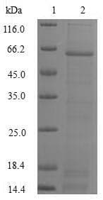 Human DFFA / ICAD / DFF45 Protein (Recombinant GST, N-terminus)