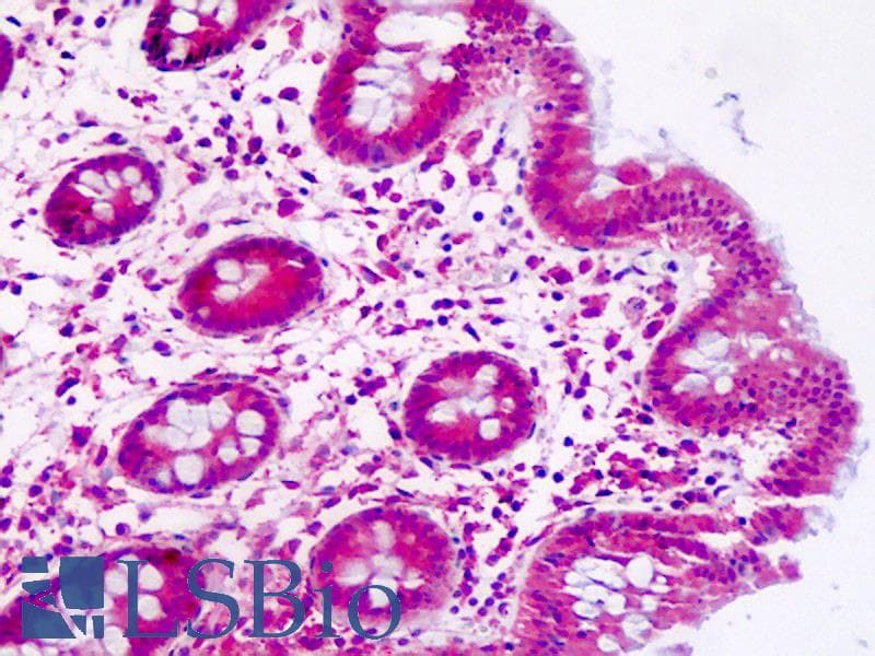 IHC-plus™ PPIC / Cyclophilin C Antibody (clone AT3C6)
