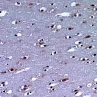 IHC-plus™ Polyclonal Rabbit anti-Human CDH11 / Cadherin 11 Antibody (IHC, WB)