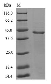 Human GABARAPL1 / ATG8 Protein (Recombinant GST, N-terminus)