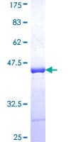 Human GNT-V / MGAT5 Protein (Recombinant GST, N-terminus)