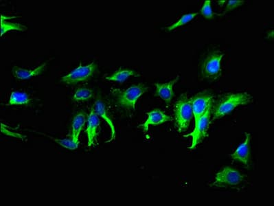 Polyclonal Rabbit anti-Human C5orf28 Antibody