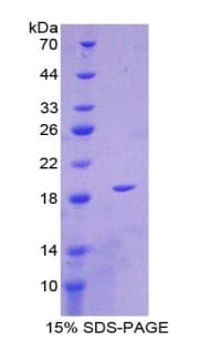 Human IL36RN / IL1F5 Protein (Recombinant His-T7)