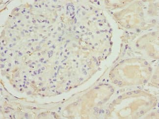 SLC22A11 Antibody