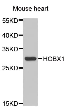 Polyclonal Rabbit anti-Human HOXB1 Antibody (IHC, WB)