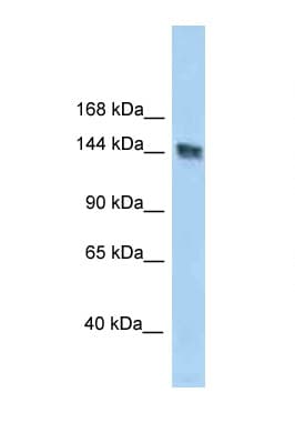 UACA Antibody (aa1309-1358)