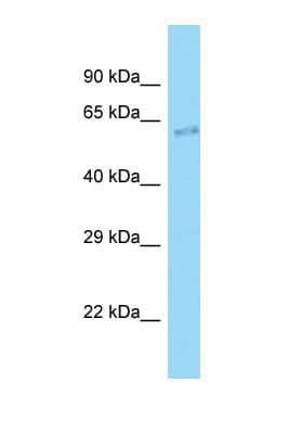 CLIP3 Antibody (N-Terminus)