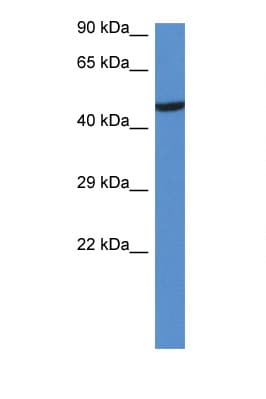 Polyclonal Rabbit anti-Mouse LYN Antibody (aa43-92, WB)