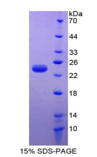 Mouse PARK7 / DJ-1 Protein (Recombinant His)
