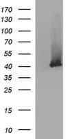 SERPINB3 Antibody (clone OTI1F10)