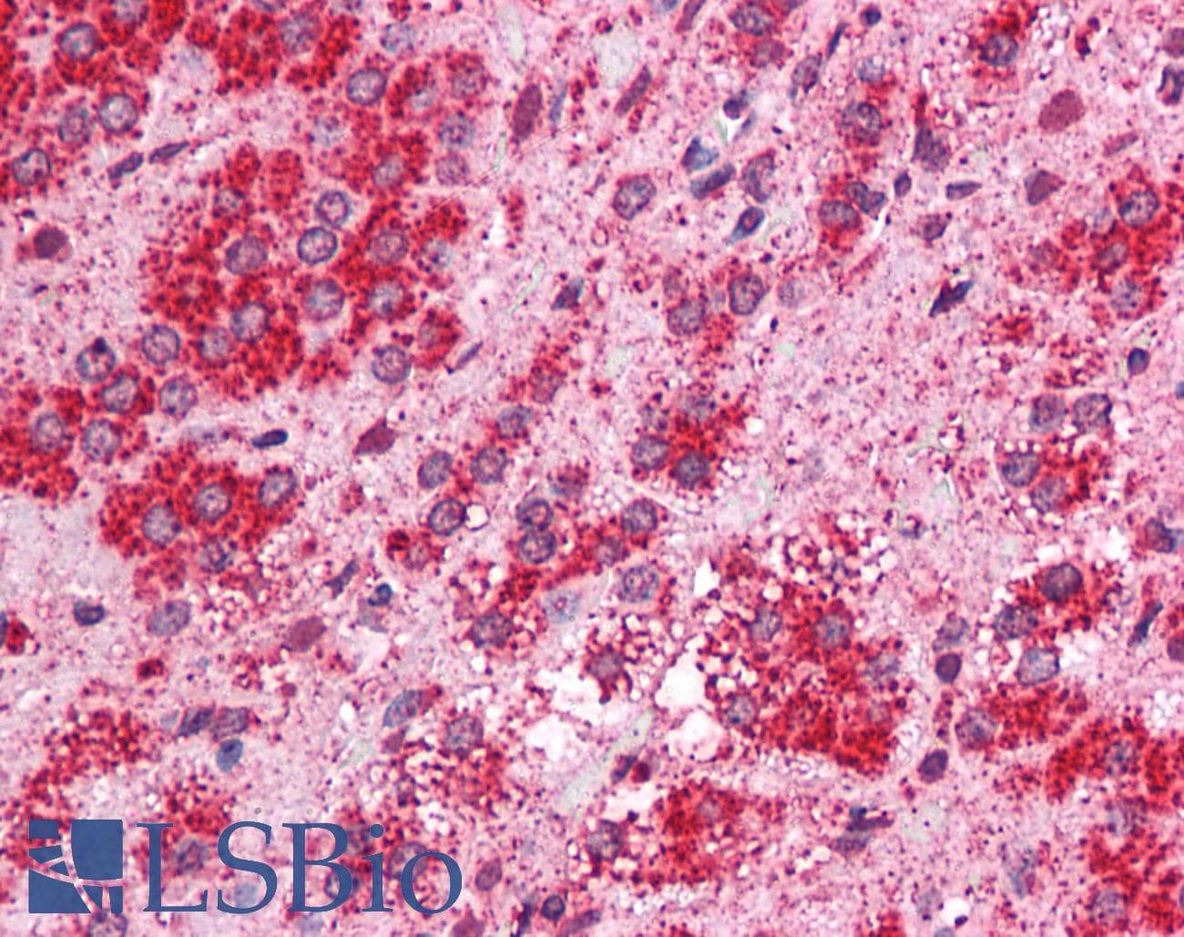 IHC-plus™ TMEM33 Antibody (Internal)