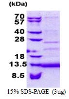 Human CD59 Protein (Recombinant His)