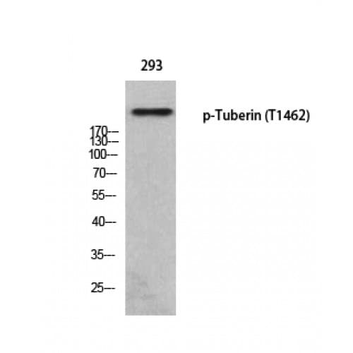 Tuberin / TSC2 Antibody (1400-1480 aa)