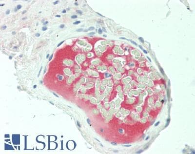 Complement C5 Antibody