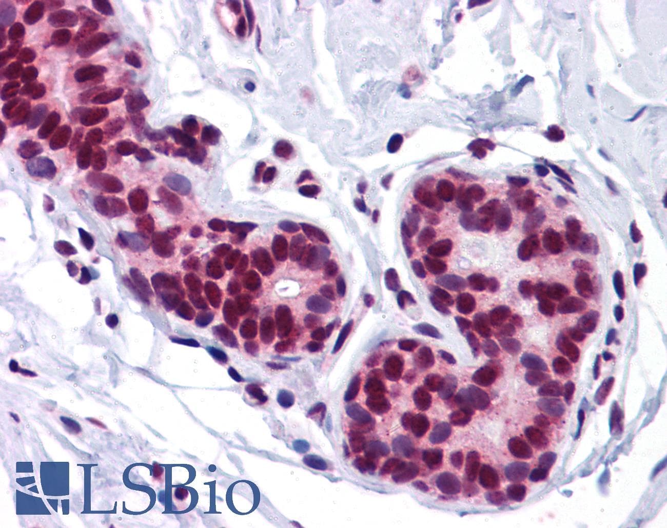 IHC-plus™ Polyclonal Rabbit anti-Human FOXO3 / FOXO3A Antibody (IHC, IF, WB)