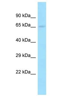 Polyclonal Rabbit anti-Human CFAP221 / PCDP1 Antibody (aa398-447, WB)