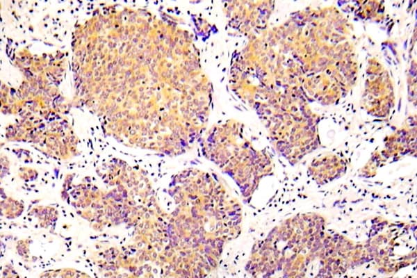 Polyclonal Rabbit anti-Human CFL1 / Cofilin Antibody (phospho-Ser3, IHC)