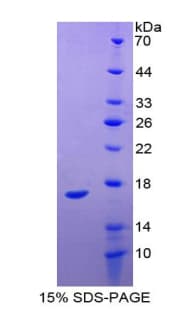 Human MDK / Midkine Protein (Recombinant His-T7)