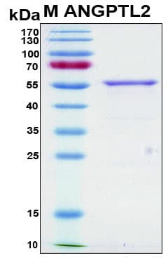 Human ANGPTL2 / ARP2 Protein (Recombinant 6His, N-terminus)