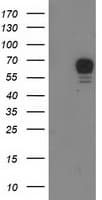 RPS6KB1 / P70S6K / S6K Antibody (clone OTI4G4)