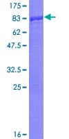 Human SMAD1 Protein (Recombinant GST)