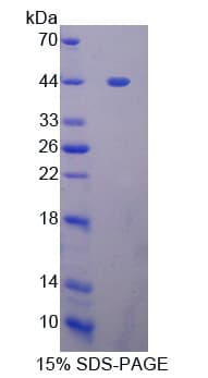 Rat GLI / GLI1 Protein (Recombinant His-T7)