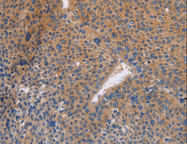 NEK8 Antibody