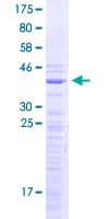 Human SNRPD1 / SMD1 Protein (Recombinant GST)