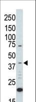MAPK1 / ERK2 Antibody (aa254-285)