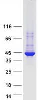 Human ARRDC5 Protein (Recombinant Myc-DDK (Flag))