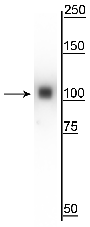 ACTN4 Antibody (clone 93)