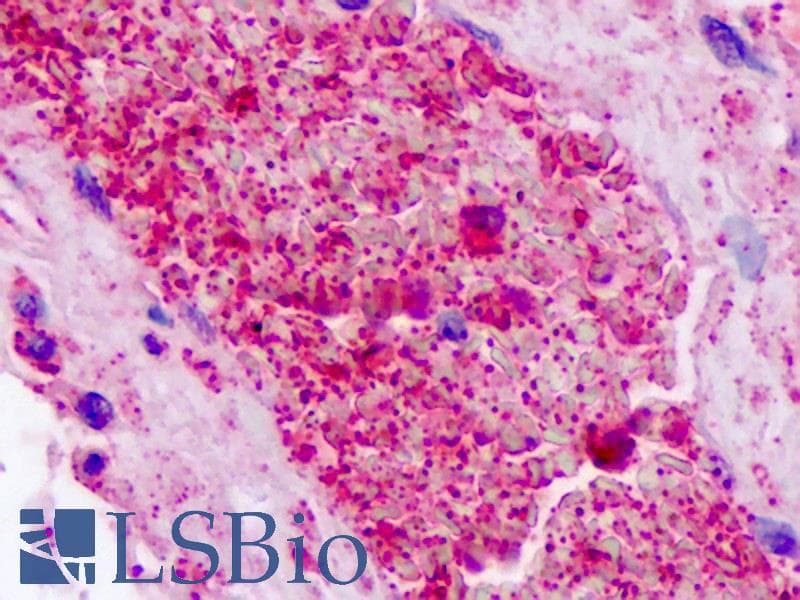 F2RL2 / PAR3 Antibody (Internal)