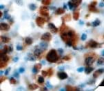 ALK Antibody (clone RBT-ALK1)