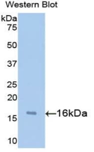 SNCA / Alpha-Synuclein Antibody (aa5-140)