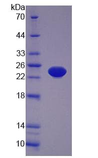 Mouse TNF Alpha Protein (Recombinant His, N-Terminal)