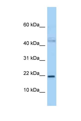 JUNDM2 / JDP2 Antibody (N-Terminus)